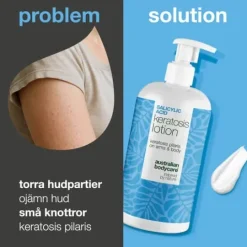Australian Bodycare Salicylic Acid Keratosis Lotion 500 ml