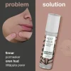 Australian Bodycare Spot Stick 9 ml