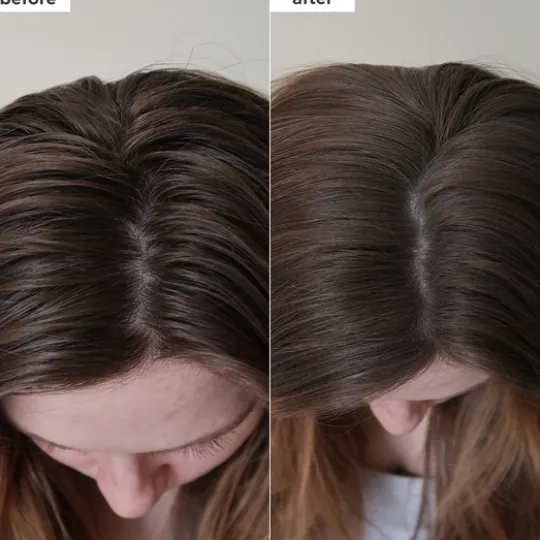 Briogeo Scalp Revival Charcoal + Biotin Dry Schampo 50 ml