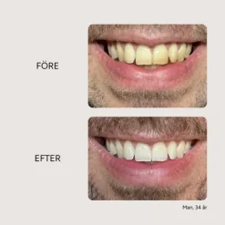 Etinour Essential Whitening & Remineralizing Kit