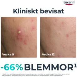 Eucerin DermoPure Triple Action Serum 40 ml