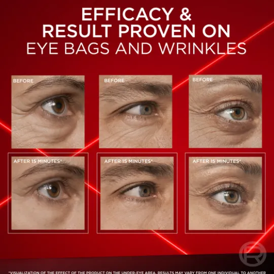 L'Oréal Paris Revitalift Laser Eye Bag Eraser 15 ml
