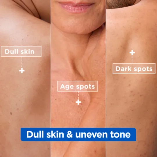 Mixa Niacinamide Bright Moisturizing Anti-Dark Spot Cream för mycket torr & matt hud 400 ml
