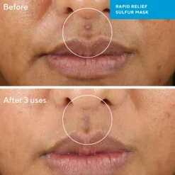 Murad Rapid Relief Sulfur Mask 75 ml