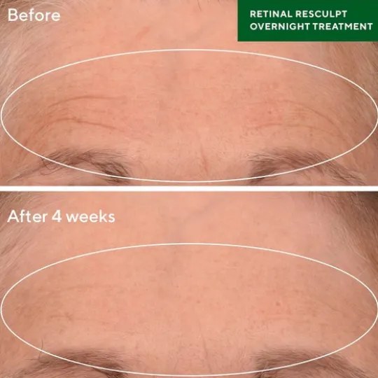 Murad Retinal Resculpt Overnight Treatment 30 ml