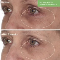Murad Retinol Youth Renewal Oil Drops 30 ml