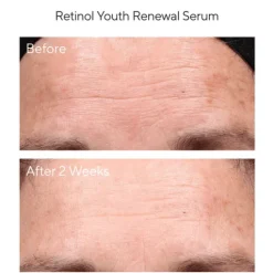 Murad Retinol Youth Renewal Serum 30 ml