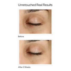 Murad Vita-C Eyes Dark Circle Corrector 15 ml