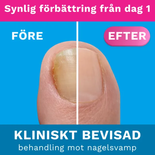 Nalox Forte 30 ml