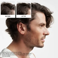 Nioxin System 2 Loyalty Kit
