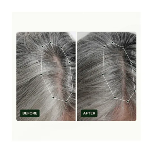 Scandinavian Biolabs Hair Routine Kit Women