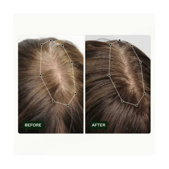 Scandinavian Biolabs Hair Routine Kit Women