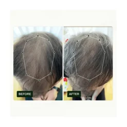 Scandinavian Biolabs Hair Routine Kit Men