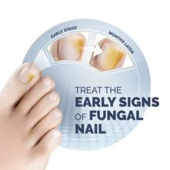 Scholl Nagelsvampbehandling