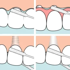 TePe Bridge & Implant Floss 30 st
