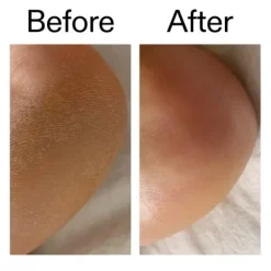 The INKEY List Glycolic Acid Exfoliating Body Stick 45 g