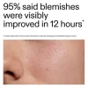 The INKEY List Succinic Acid Treatment 15 ml