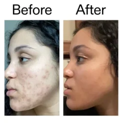 The INKEY List Tranexamic Acid Serum 30 ml